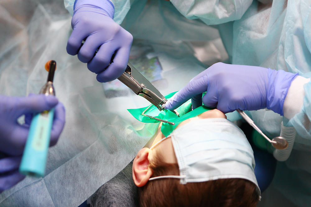 pediatric dental surgery